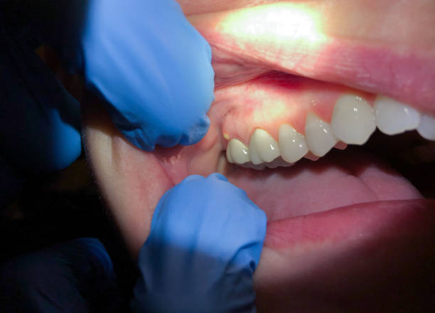 Professional Emergency Dental Service in WA